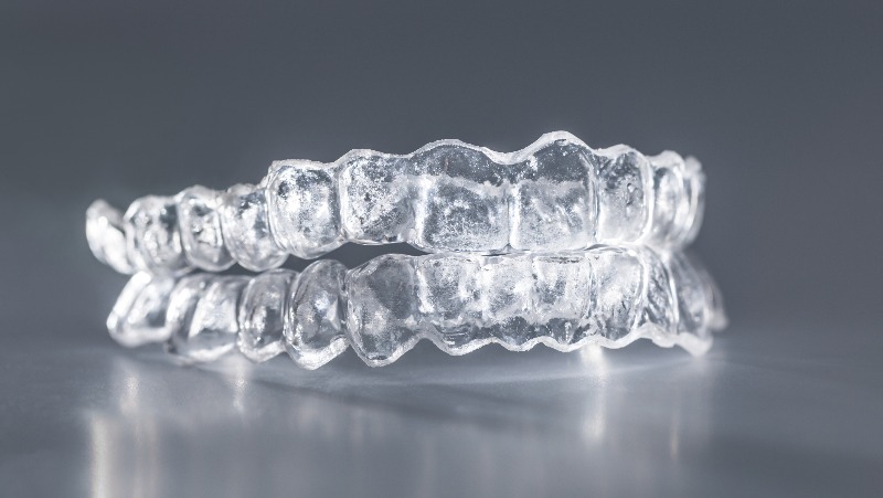 Clear Aligners – Correzione dei denti in modo discreto ed efficace